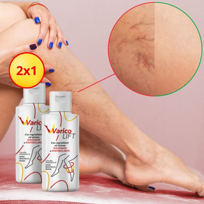 Varicolift crema per vene varicose